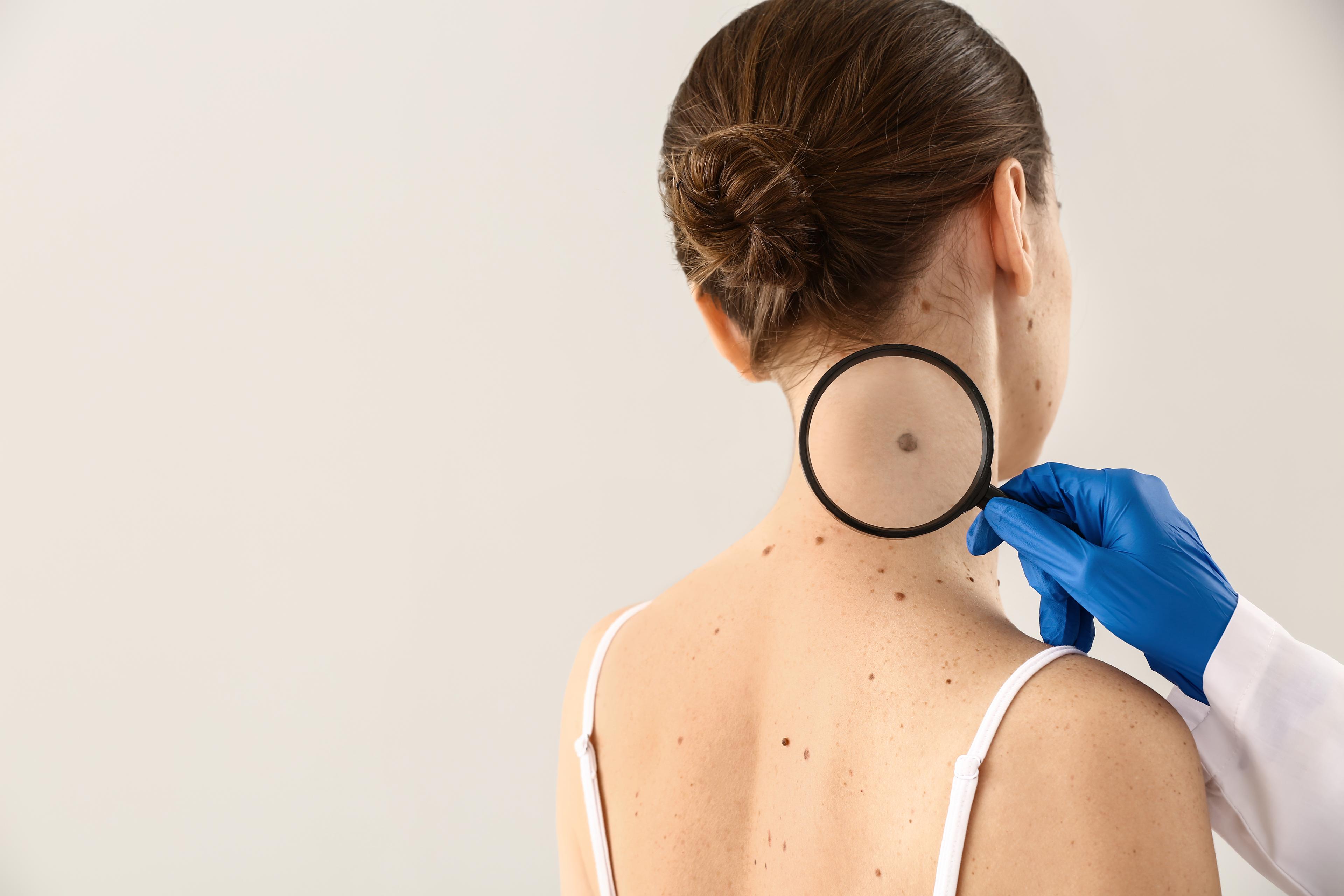 Clínica de Dermatología