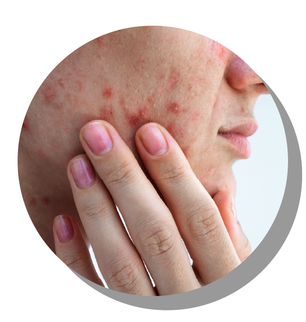 Consulta dermatológica clínica